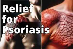 The Ultimate Guide To Cbd Oil Benefits For Psoriasis Relief